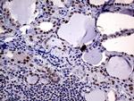 MLH1 Antibody in Immunohistochemistry (Paraffin) (IHC (P))