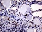 MLH1 Antibody in Immunohistochemistry (Paraffin) (IHC (P))
