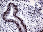 MLH1 Antibody in Immunohistochemistry (Paraffin) (IHC (P))