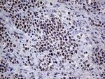 MLH1 Antibody in Immunohistochemistry (Paraffin) (IHC (P))