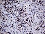 MLH1 Antibody in Immunohistochemistry (Paraffin) (IHC (P))