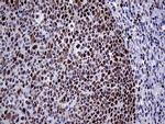MLH1 Antibody in Immunohistochemistry (Paraffin) (IHC (P))
