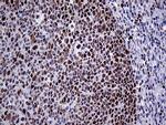 MLH1 Antibody in Immunohistochemistry (Paraffin) (IHC (P))
