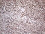 MLH1 Antibody in Immunohistochemistry (Paraffin) (IHC (P))
