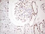 MLH1 Antibody in Immunohistochemistry (Paraffin) (IHC (P))