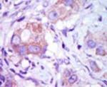 MLK1 Antibody in Immunohistochemistry (IHC)