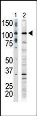 MLK1 Antibody in Western Blot (WB)