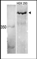 KMT2C Antibody in Western Blot (WB)