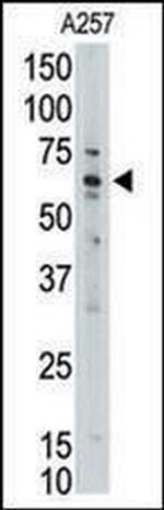 MLLT1 Antibody in Western Blot (WB)