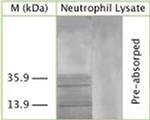 LC3A Antibody in Western Blot (WB)