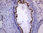 MLPH Antibody in Immunohistochemistry (Paraffin) (IHC (P))
