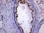 MLPH Antibody in Immunohistochemistry (Paraffin) (IHC (P))