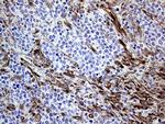 MLPH Antibody in Immunohistochemistry (Paraffin) (IHC (P))