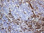 MLPH Antibody in Immunohistochemistry (Paraffin) (IHC (P))
