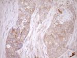 MLPH Antibody in Immunohistochemistry (Paraffin) (IHC (P))