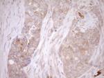 MLPH Antibody in Immunohistochemistry (Paraffin) (IHC (P))