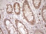 MLPH Antibody in Immunohistochemistry (Paraffin) (IHC (P))