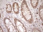 MLPH Antibody in Immunohistochemistry (Paraffin) (IHC (P))