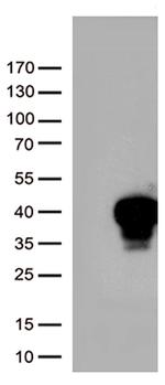 MLX Antibody in Western Blot (WB)
