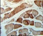 MMAA Antibody in Immunohistochemistry (IHC)