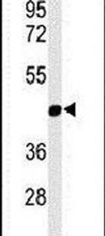 MMAA Antibody in Western Blot (WB)