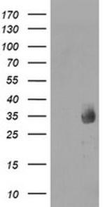 MMACHC Antibody in Western Blot (WB)