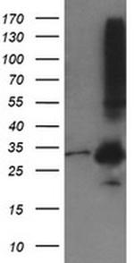 MMACHC Antibody in Western Blot (WB)