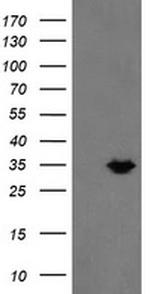 MMACHC Antibody in Western Blot (WB)