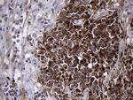 MME Antibody in Immunohistochemistry (Paraffin) (IHC (P))