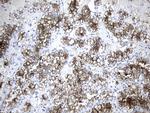 MME Antibody in Immunohistochemistry (Paraffin) (IHC (P))