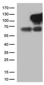 MME Antibody in Western Blot (WB)