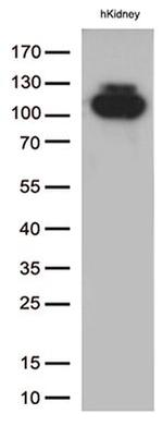 MME Antibody in Western Blot (WB)