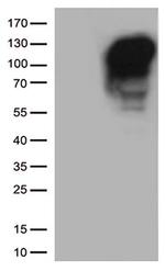 MME Antibody in Western Blot (WB)