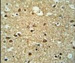 MMGT1 Antibody in Immunohistochemistry (IHC)