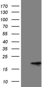 MMGT1 Antibody in Western Blot (WB)