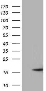 MMGT1 Antibody in Western Blot (WB)
