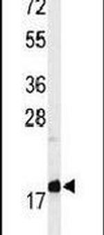 MMGT1 Antibody in Western Blot (WB)