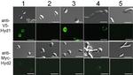 Myc Tag Antibody in Immunocytochemistry (ICC/IF)