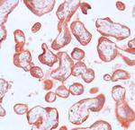 MMP23 Antibody in Immunohistochemistry (IHC)