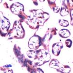 MMP2 Antibody in Immunohistochemistry (IHC)