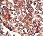 MMP13 Antibody in Immunohistochemistry (IHC)
