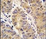 MMP13 Antibody in Immunohistochemistry (IHC)