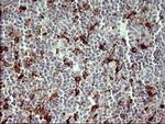 MMP13 Antibody in Immunohistochemistry (Paraffin) (IHC (P))