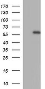MMP13 Antibody in Western Blot (WB)