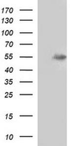 MMP13 Antibody in Western Blot (WB)