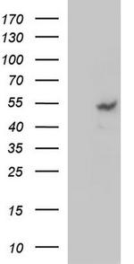 MMP13 Antibody in Western Blot (WB)