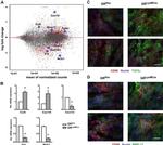 MMP13 Antibody in Immunohistochemistry (IHC)