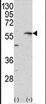 MMP13 Antibody in Western Blot (WB)