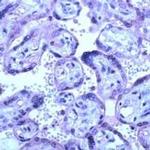 MMP14 Antibody in Immunohistochemistry (IHC)