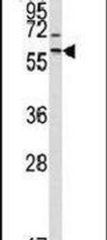 MMP17 Antibody in Western Blot (WB)